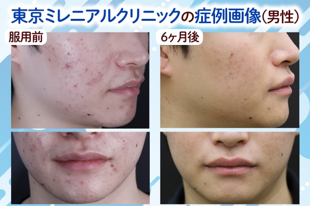 東京ミレニアルクリニックの男性の症例画像