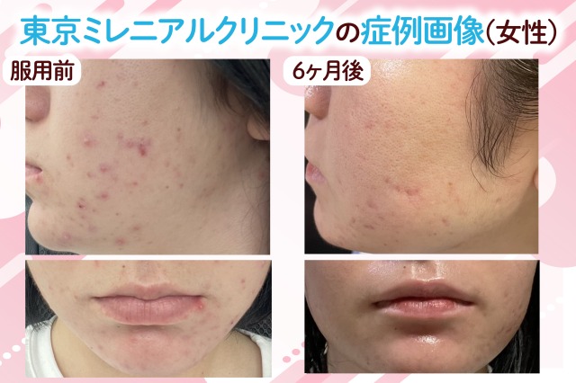 東京ミレニアルクリニックの女性の症例画像