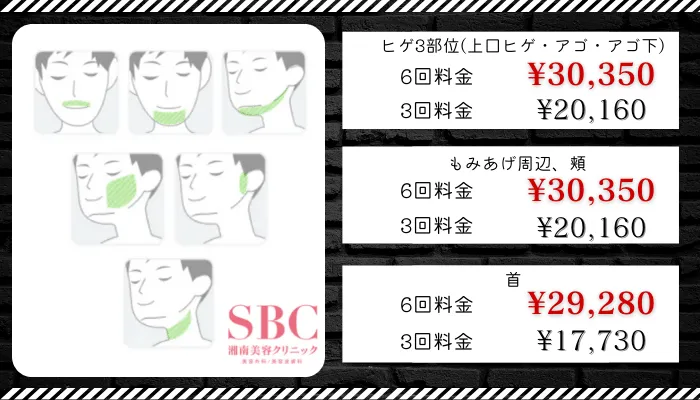 湘南美容クリニック札幌比較料金
