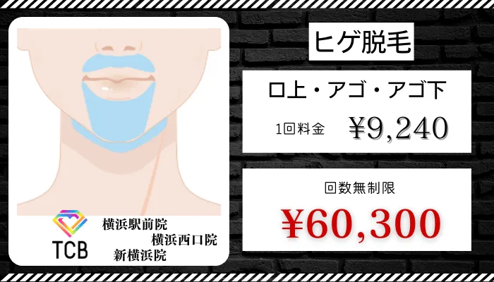 TCBメンズ横浜比較料金