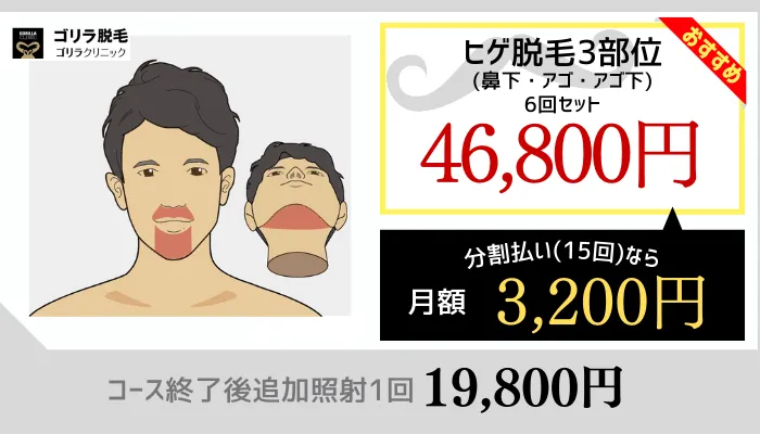 ゴリラクリニックヒゲ脱毛セットプラン