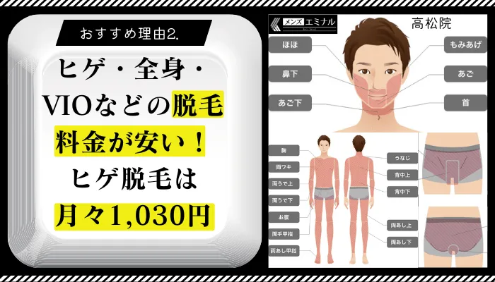 メンズエミナル高松おすすめ理由2