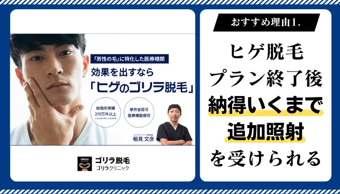 ゴリラクリニックおすすめ理由1