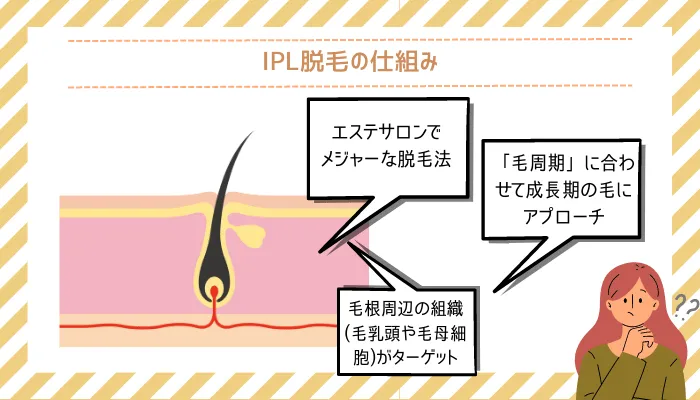 IPL脱毛の仕組み