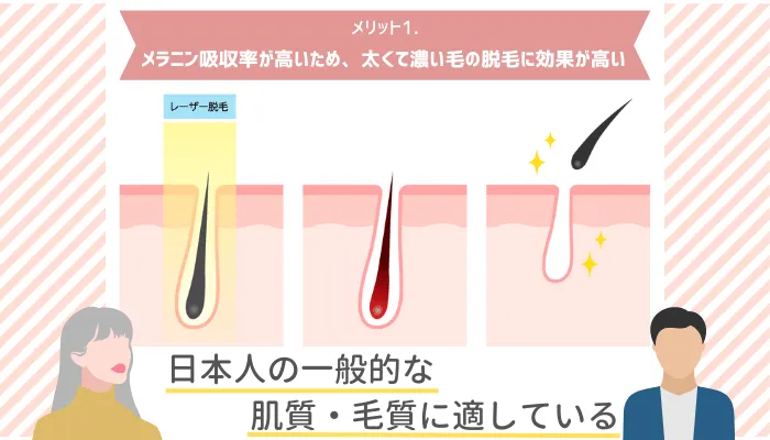 アレキサンドライトレーザーメリット1