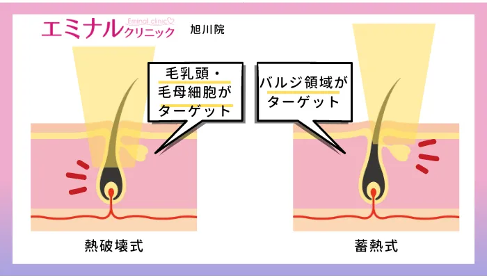 エミナルクリニック旭川熱破壊式と蓄熱式