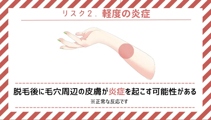 リスク2軽度の炎症