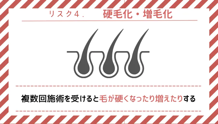 リスク4硬毛化・増毛化