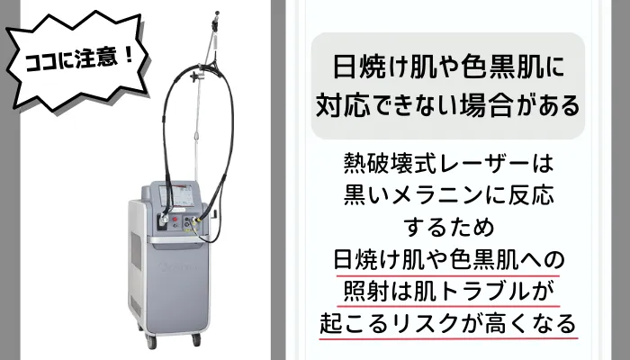 熱破壊式脱毛デメリット