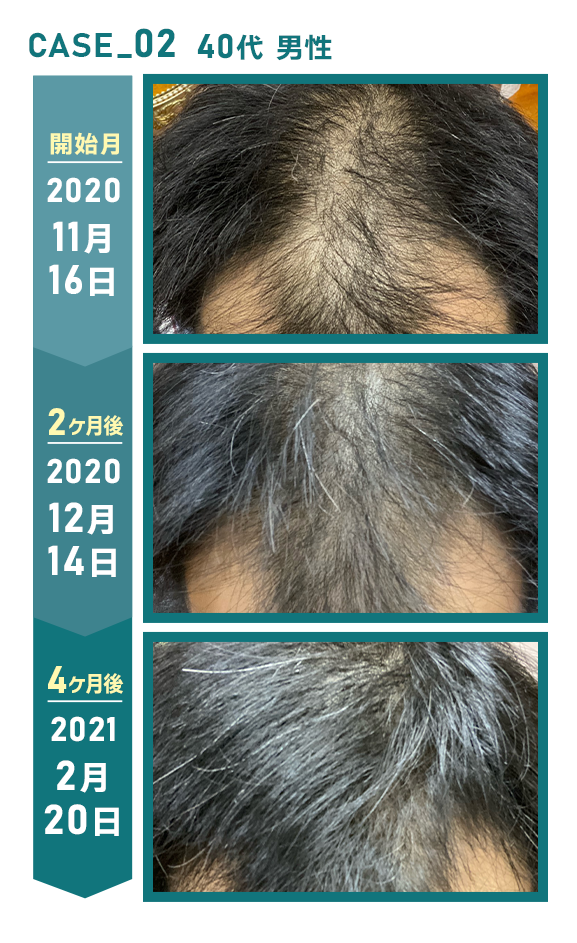 クリニックフォアAGA治療の口コミは？治療効果やかかる料金、オンライン診療について徹底解説