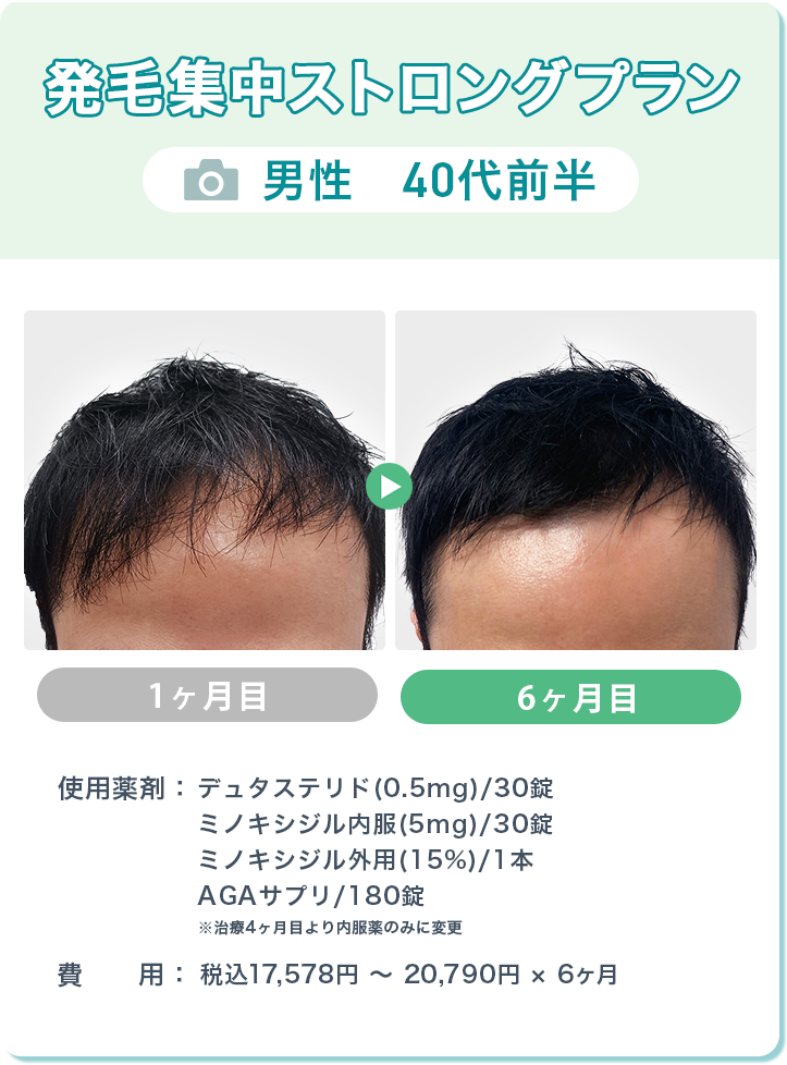 クリニックフォアAGA治療の口コミは？治療効果やかかる料金、オンライン診療について徹底解説