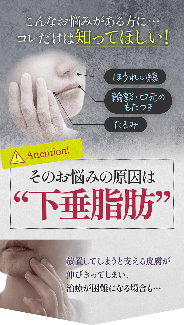 ほうれい線、輪郭・口元のもたつき、たるみなどのお悩みがある方に・・・そのお悩みの原因は下垂脂肪。放置してしまうと支える皮膚が
				伸びきってしまい、治療が困難になる場合も…