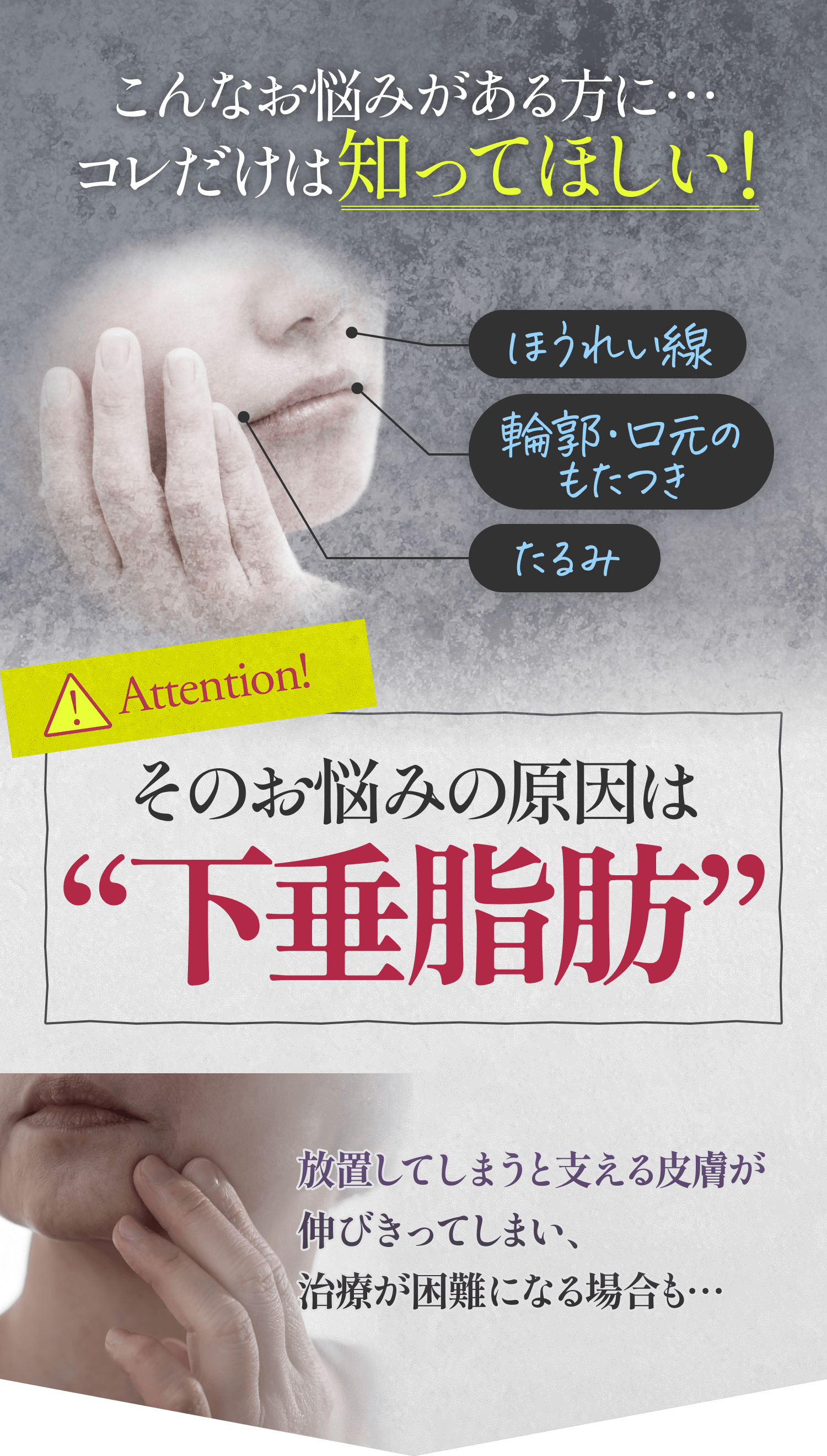 ほうれい線、輪郭・口元のもたつき、たるみなどのお悩みがある方に・・・そのお悩みの原因は下垂脂肪。放置してしまうと支える皮膚が
            伸びきってしまい、治療が困難になる場合も…