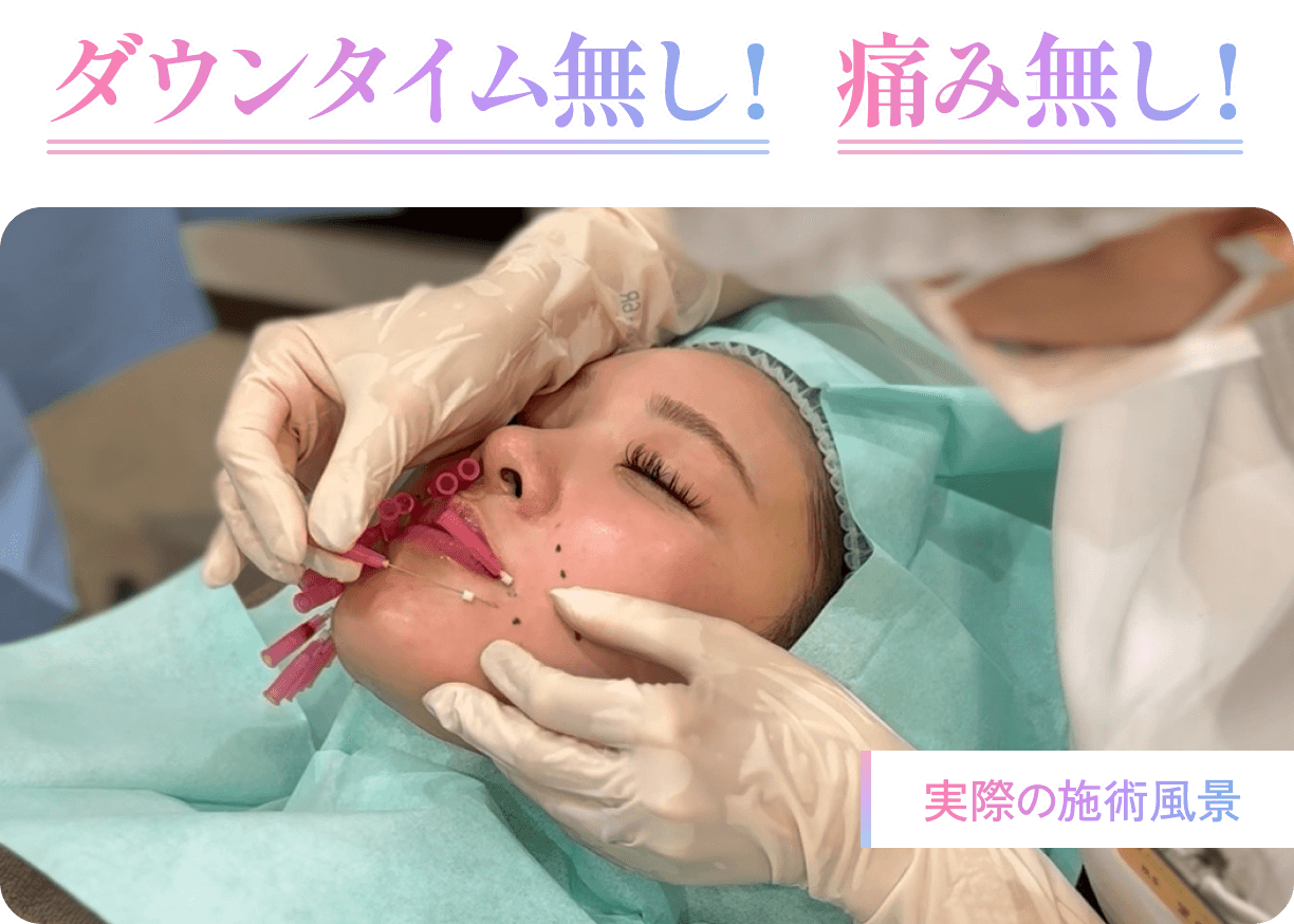 ダウンタイム無し！痛み無し！