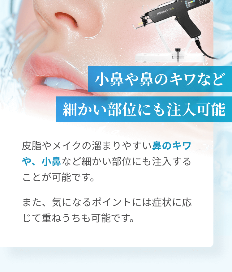 小鼻や鼻のキワなど細かい部位にも注入可能 | 皮脂やメイクの溜まりやすい鼻のキワや、小鼻、目尻など細かい部位にも注入可能です。また、気になるポイントには症状に応じて重ねうちも可能です。