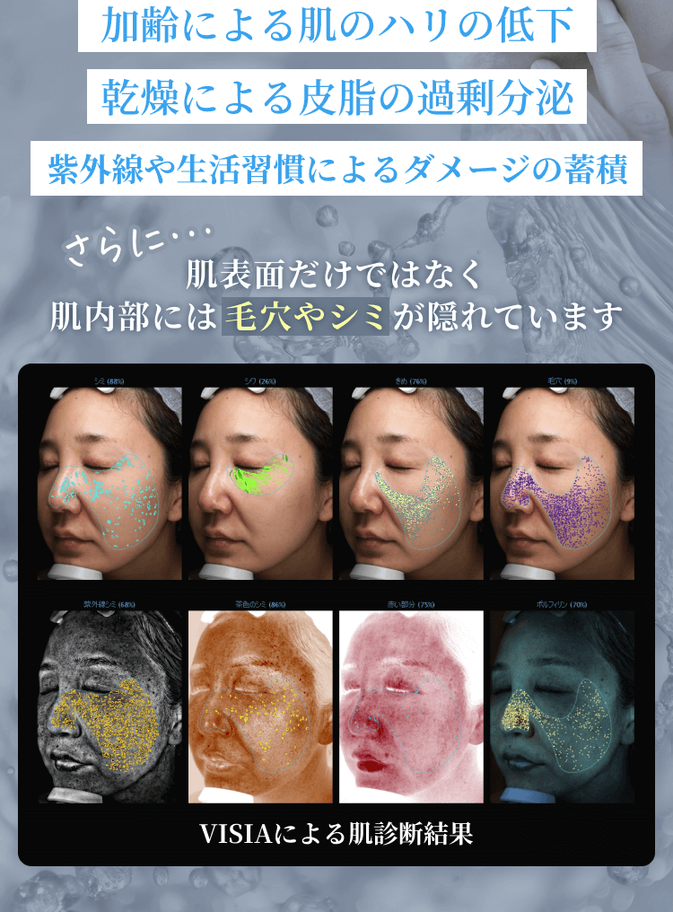 20代をピークに、肌内部のコラーゲンやヒアルロン酸が減少していくからです。肌表面だけではなく肌内部には 毛穴やシミ が隠れています