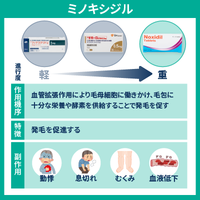 ミノキシジルについての説明画像