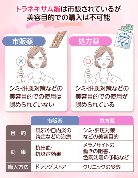 トラネキサム酸は市販されているが美容目的での購入は不可能