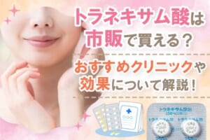 トラネキサム酸（トランサミン）の市販薬のおすすめは？ドラッグストアで購入できるのか調査
